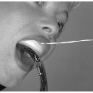 Divers Larynx