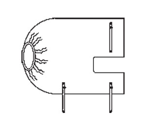 vignette du produit Housse C-Arm ampli Fluoroscan