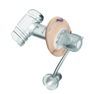 TRACOE larynx button plus-0