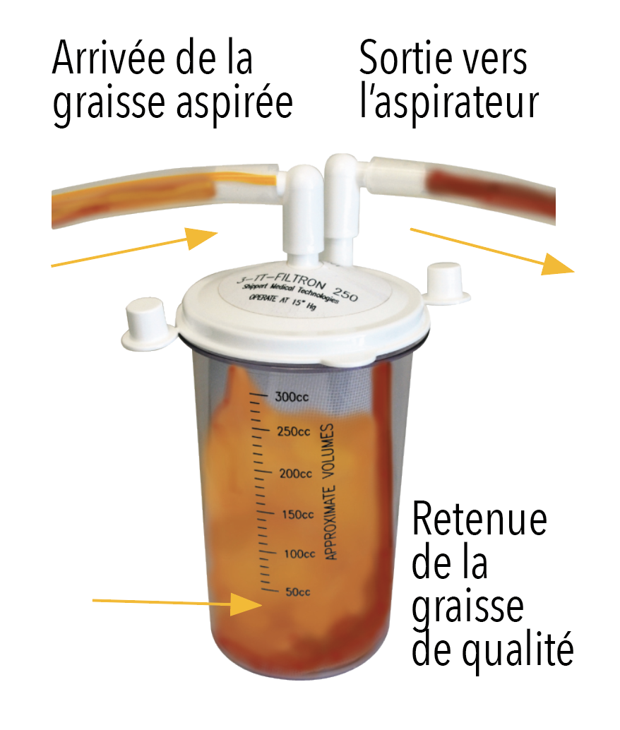 schema_transfiltron