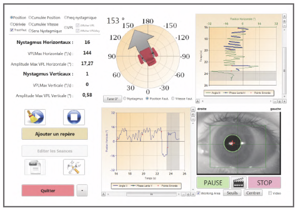 Vidéonystagmoscope avec écran intégré Framiral – Image 3