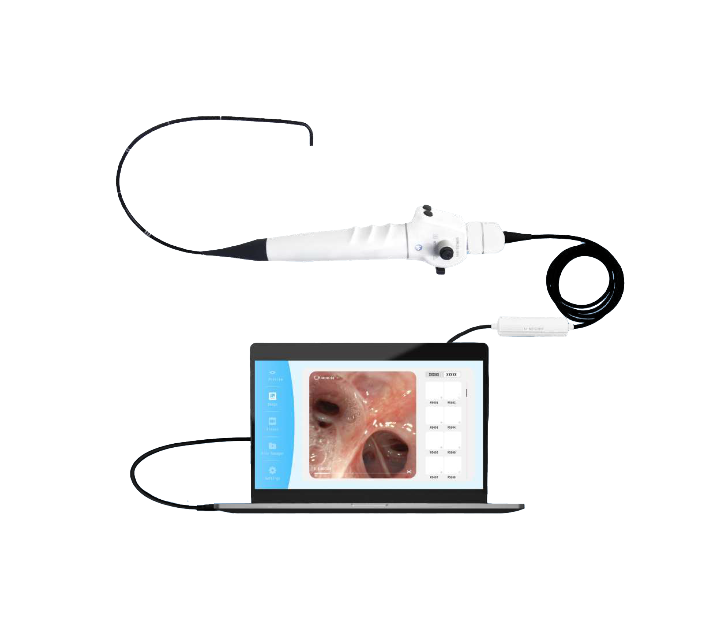 Câble USB-A pour vidéo rhino-laryngoscope HD Mindsion – Image 2