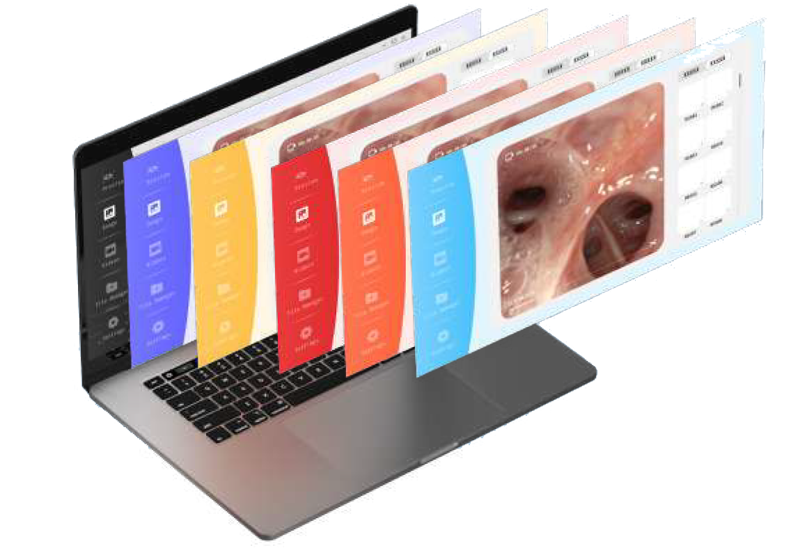 Câble USB-A pour vidéo rhino-laryngoscope HD Mindsion – Image 4